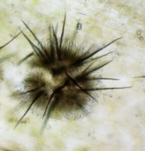 Figure 5: A microscopic view of a single spore mass shows the crescent moon-shaped spores which spread to other plants to cause new infections.