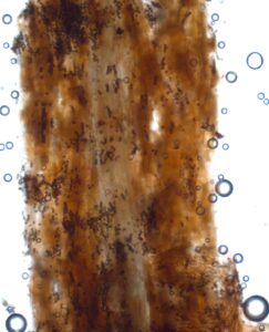Looking at sectioned black root reveals numerous chlamydospores.