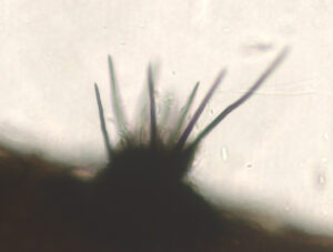 Anthracnose fungi in the genus Colletotrichum are characterized by the presence of black needle-like structures called setae